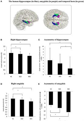 Asymmetry of Hippocampus and Amygdala Defect in Subjective Cognitive Decline Among the Community Dwelling Chinese